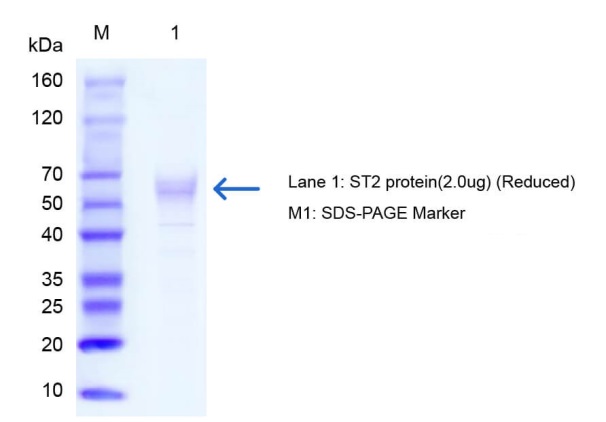 ST2-protein-SDS-PAGE-WB-OkayBio
