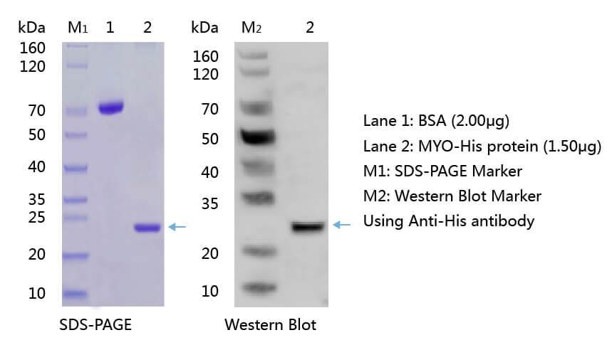肌红蛋白（MYO）的SDS-PAGE和WB分析图