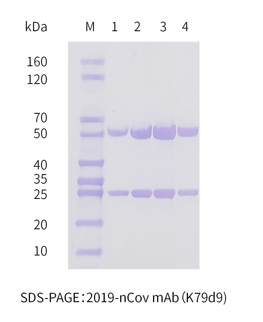 2019-nCoV抗体纯化SDS-PAGE图