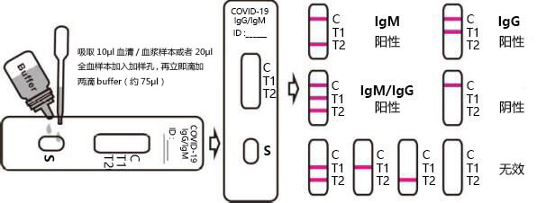 2019-nCoV检测试剂条检验结果的解释