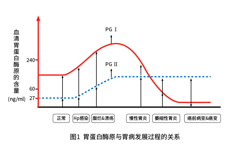 胃蛋白酶原Ⅰ（PGⅠ）和胃蛋白酶原Ⅱ（PGⅡ）与胃部疾病的关系