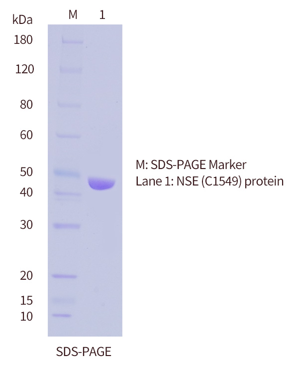 SDS-PAGE of NSE protein-E.coli-OkayBio