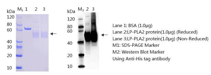 磷脂酶A2（Lp-PLA2）抗原SDS-PAGE与western blot图