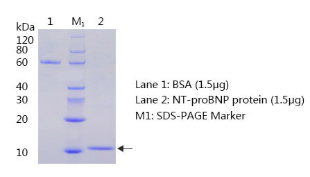 N端脑钠肽前体抗原SDS-PAGE图 N端脑钠肽前体(NT-proBNP)抗原SDS-PAGE图