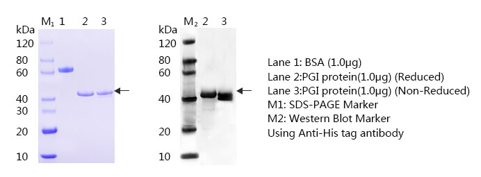 胃蛋白酶原Ⅰ（PGⅠ）抗原SDS-PAGE与western blot图