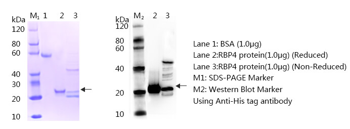 视黄醇结合蛋白（RBP4）抗原SDS-PAGE与western blot图