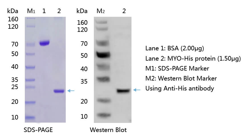 MYO SDS-PAGE and WB MYO SDS-PAGE and WB