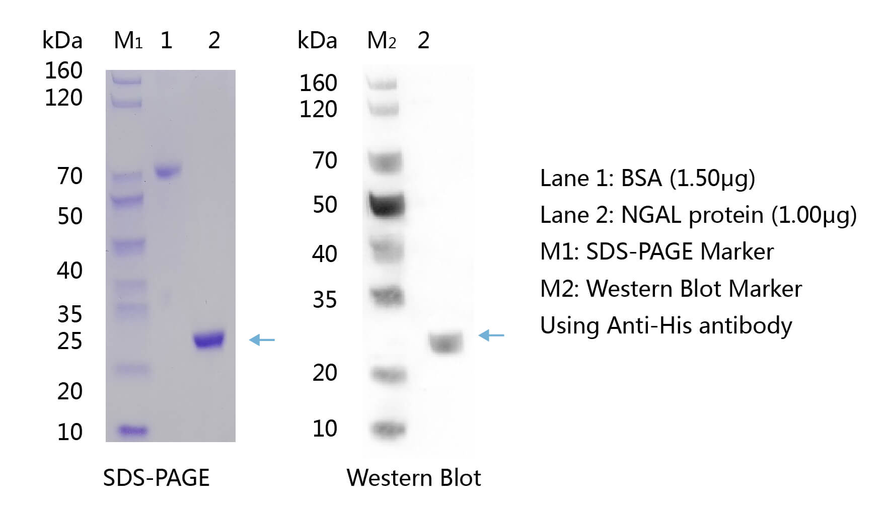 中性粒细胞明胶酶相关脂质运载蛋白（NGAL）的WB图