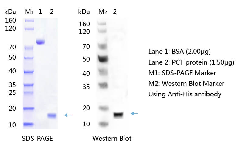 降钙素原（PCT）的SDS-PAGE和WB分析图