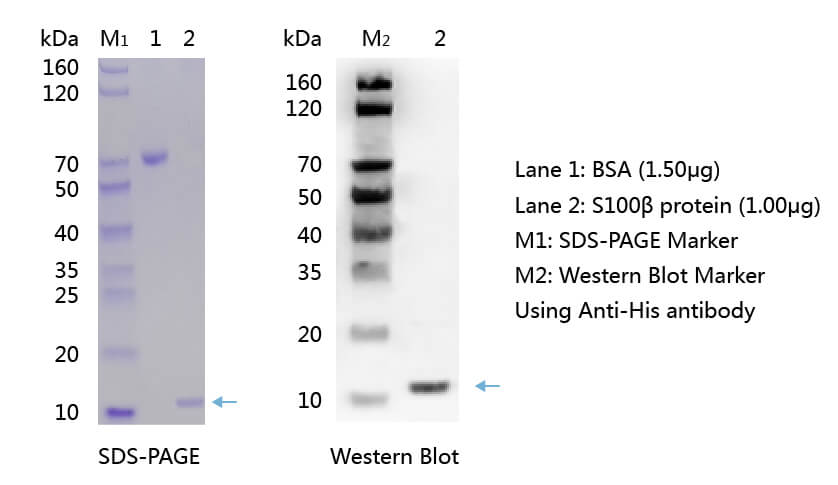 欧凯生物S100β蛋白的SDS-PAGE和WB分析图