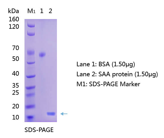 血清淀粉样蛋白A（SAA）的SDS-PAGE图