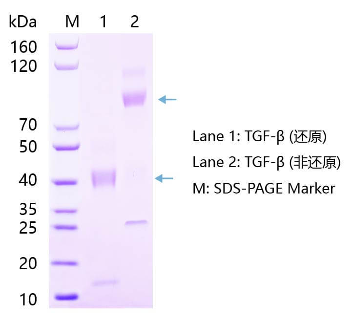 TGF-β1蛋白SDS-PAGE结果