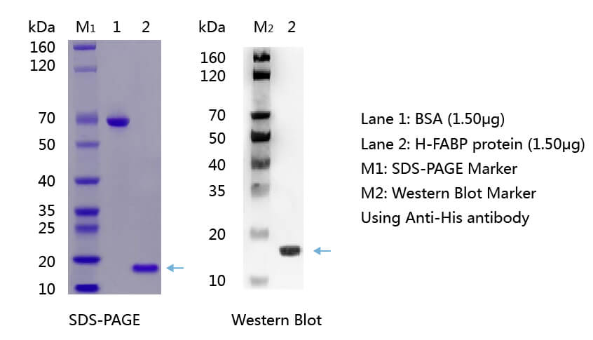 H-FABP抗原的SDS-PAGE和WB分析图