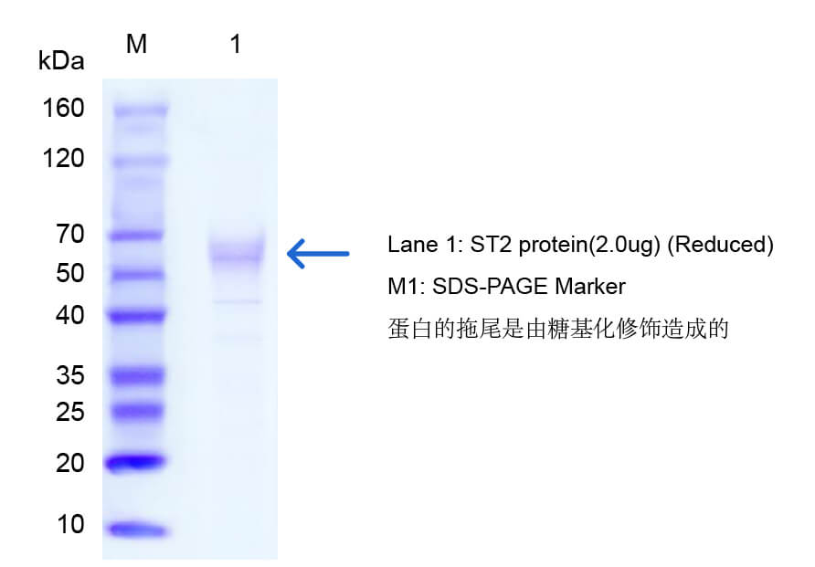 ST2抗原的SDS-PAGE图 ST2抗原的SDS-PAGE图