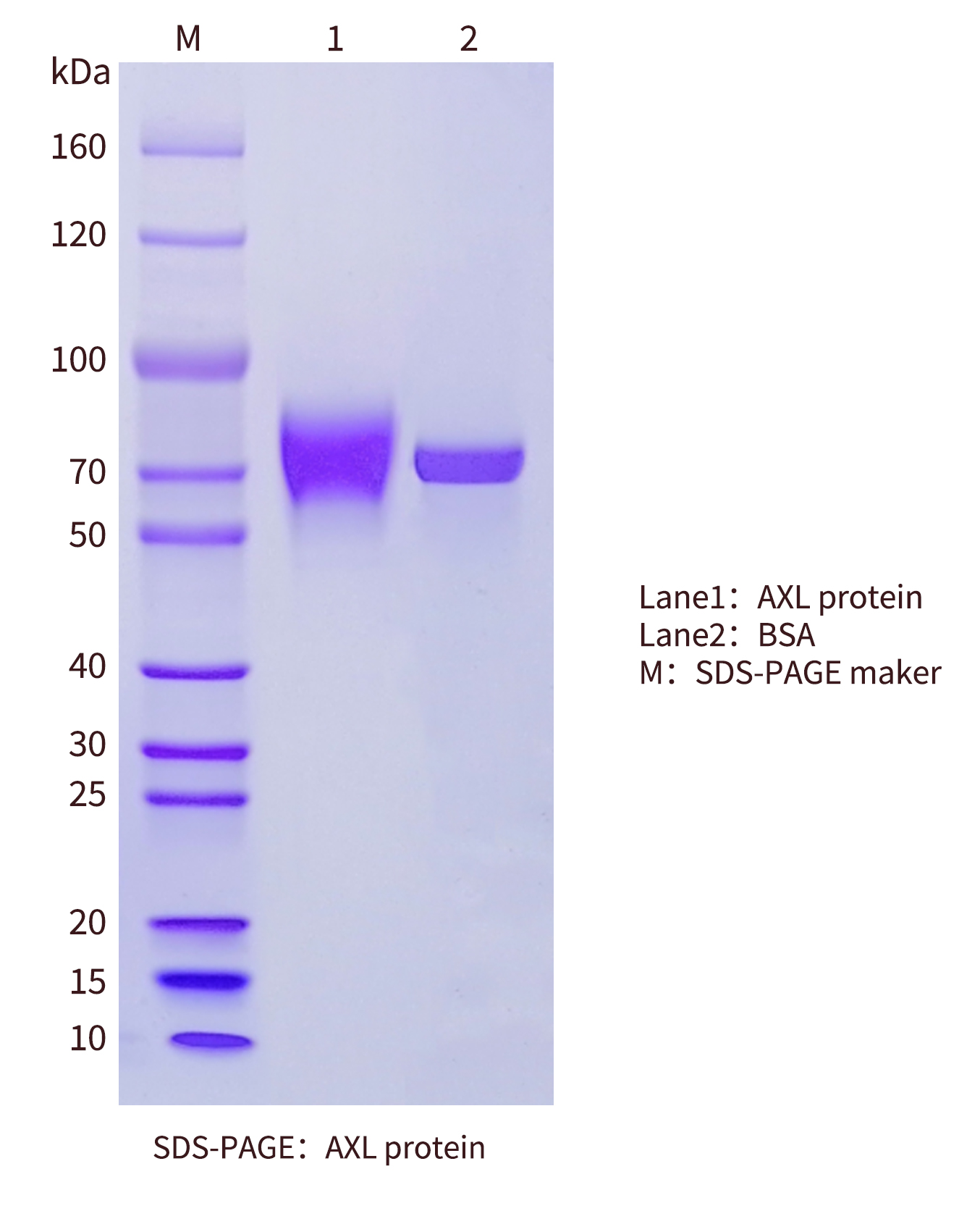 AXL-protein-SDS-PAGE