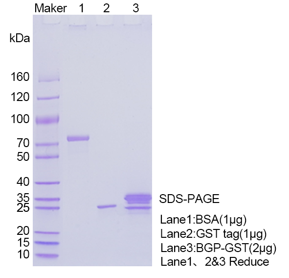 SDS-PAGE-of-BGP-protein