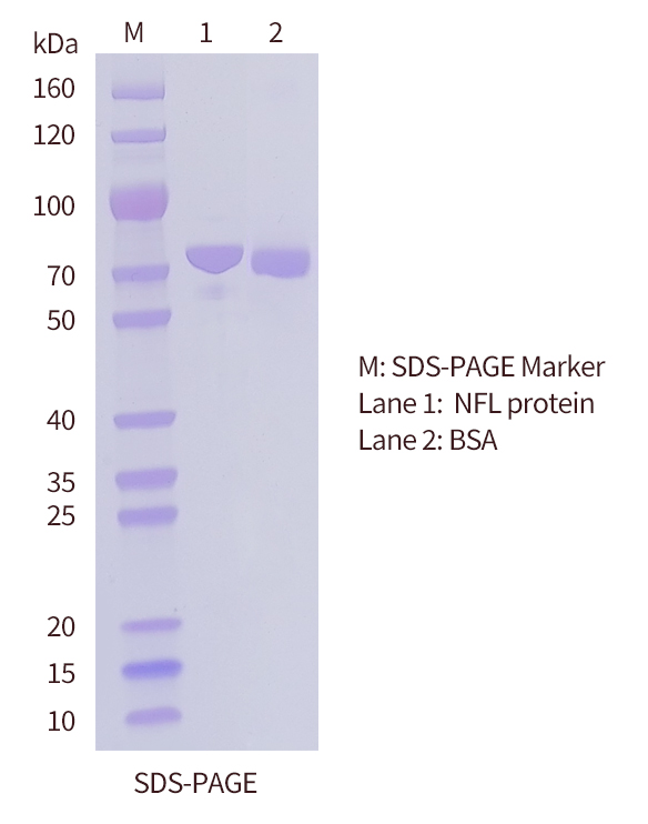 SDS-PAGE of NFL protein-OkayBio