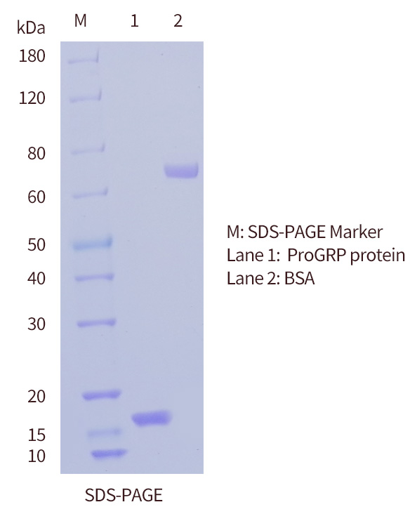 SDS-PAGE of ProGRP protein