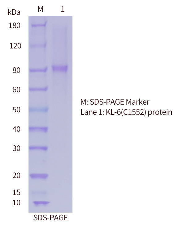 SDS-PAGE-of-KL