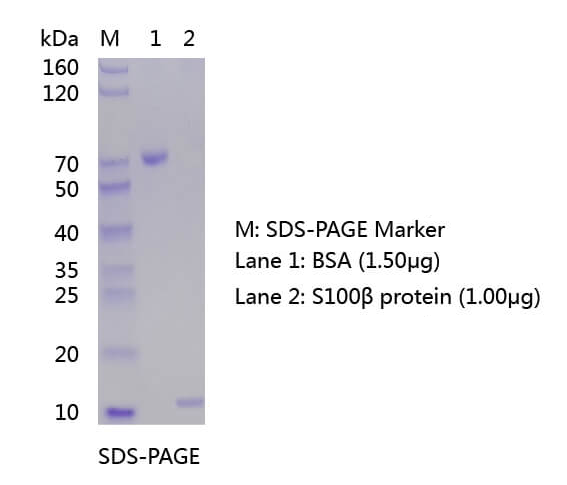 欧凯生物S100β蛋白的SDS-PAGE和WB分析图